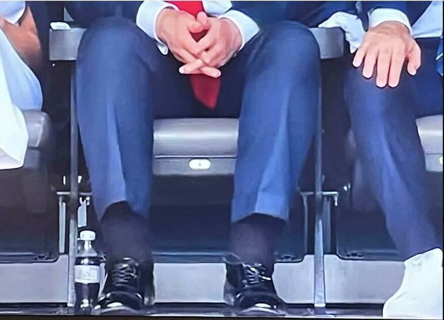 Close-up of legs and hands showing bizarre marks on Trump’s body as experts reveal possible explanations during an event.