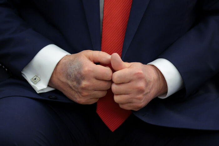 Close-up of a man’s hands adjusting a red tie, dressed in a dark suit, representing Trump at age 79 in a formal setting.