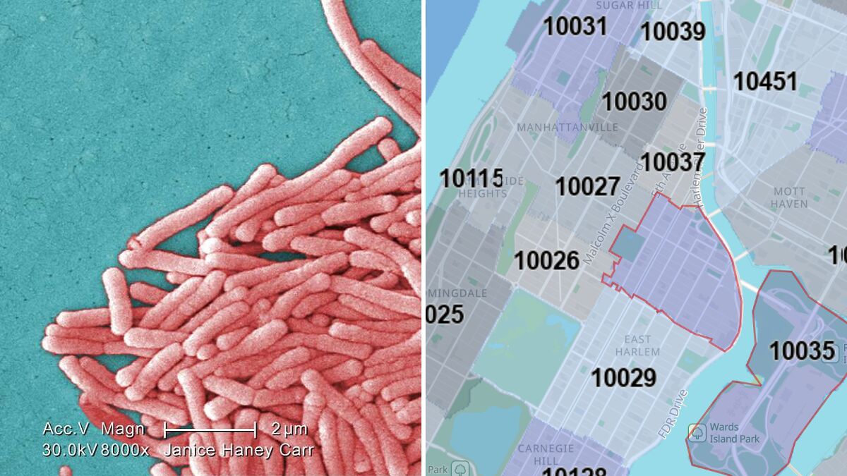 Legionnairesu2019 disease bacteria under microscope and New York City map showing outbreak areas and ZIP codes.