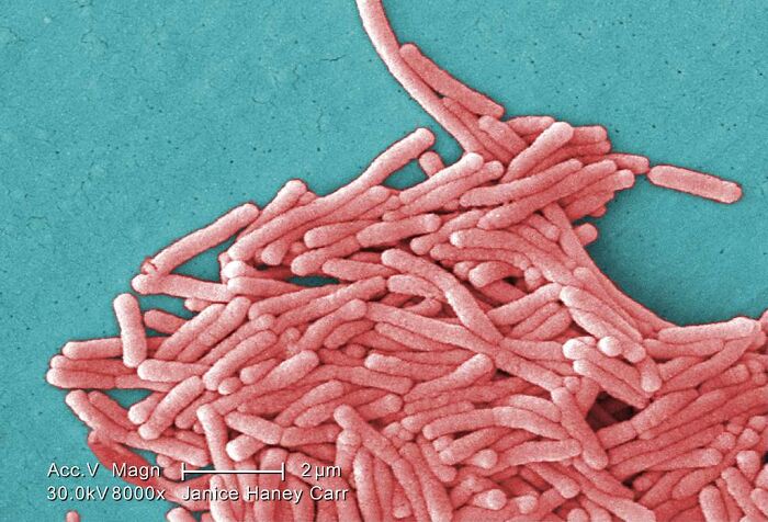 Legionella bacteria under a microscope causing Legionnaires’ disease outbreak sickening dozens in New York City.
