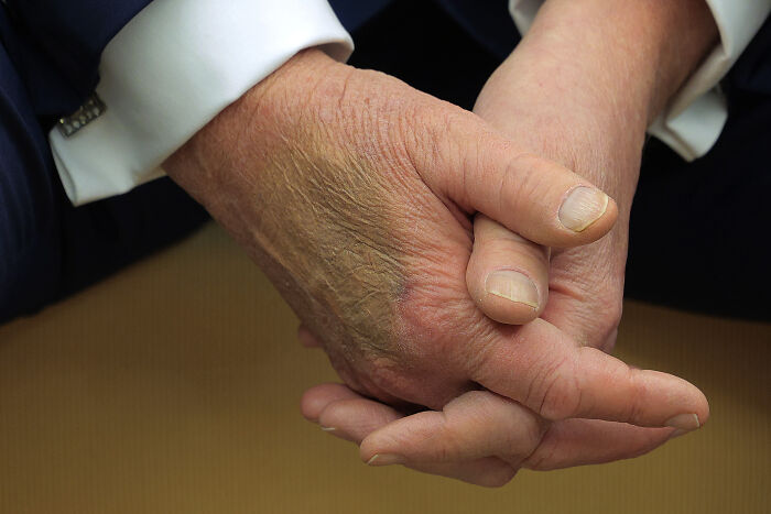 Close-up of hands clasped together, representing Trump’s declaration of being alive and well amid rumors.