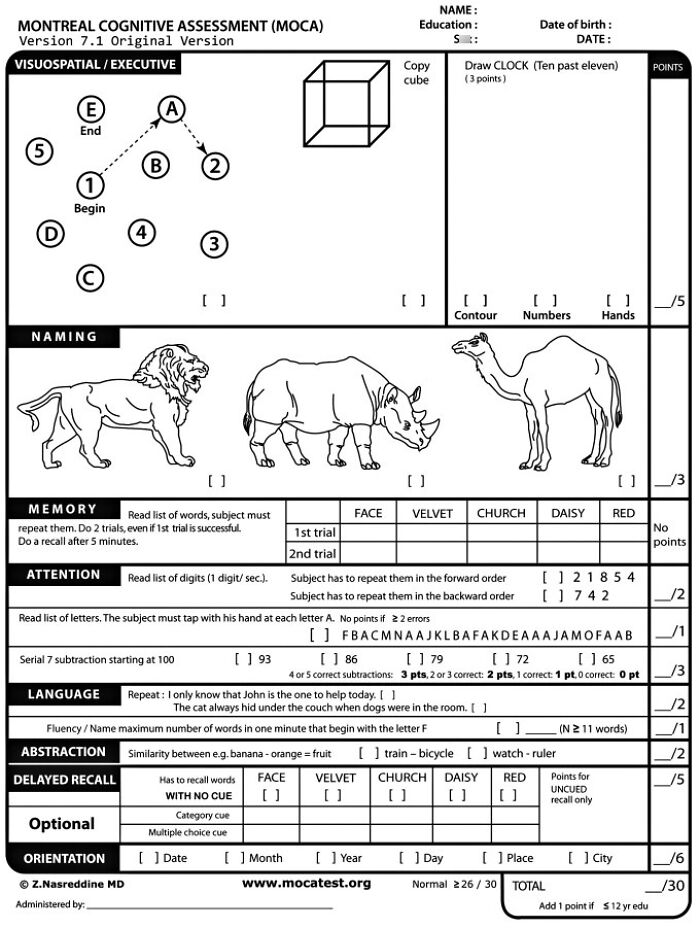 Donald Trump Appears To Confuse Dementia Test With IQ As He Challenges Dems To Beat His Score Donald Trump Appears To Confuse Dementia Test With IQ As He Challenges Dems To Beat His Score