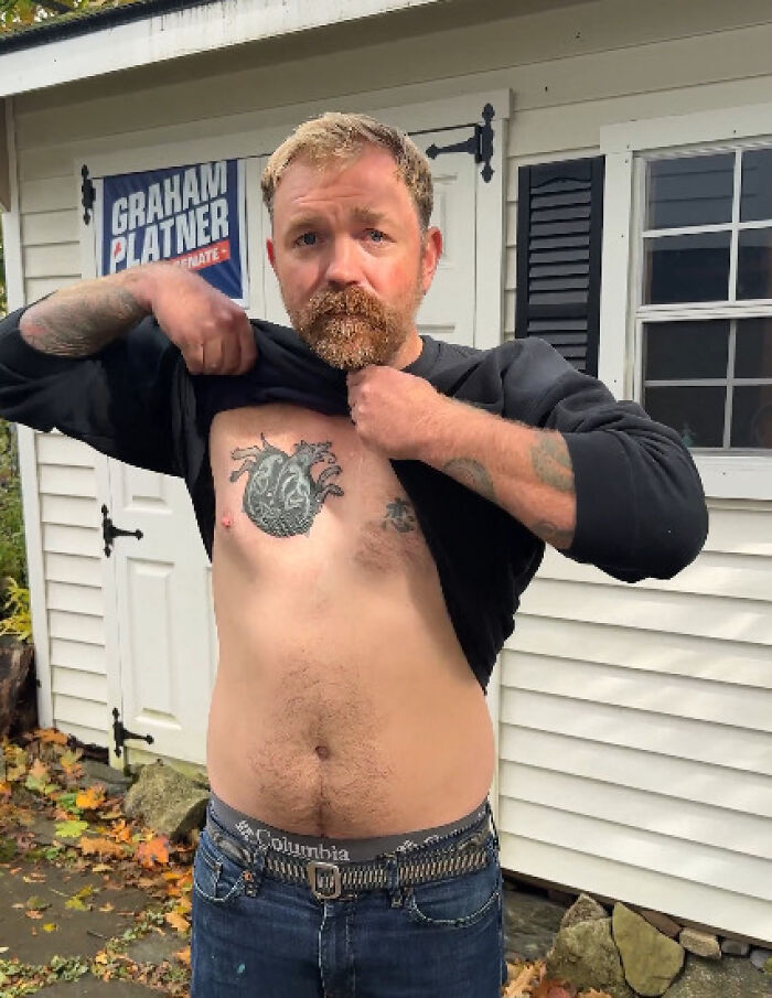 Maine Senate candidate revealing chest tattoo that was covered up after recognized as a hate symbol outdoors by a campaign sign.