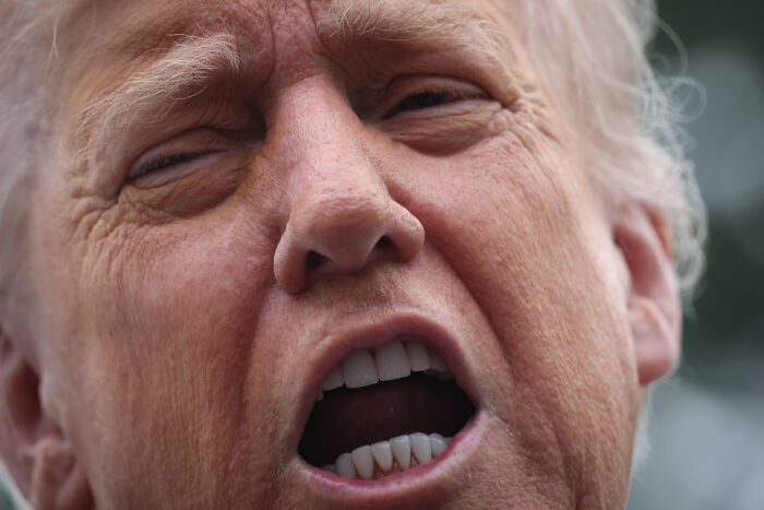 Close-up of Trump speaking outdoors, highlighting facial expressions amid claims about dementia like his father. Close-up of Trump speaking outdoors, highlighting facial expressions amid claims about dementia like his father.