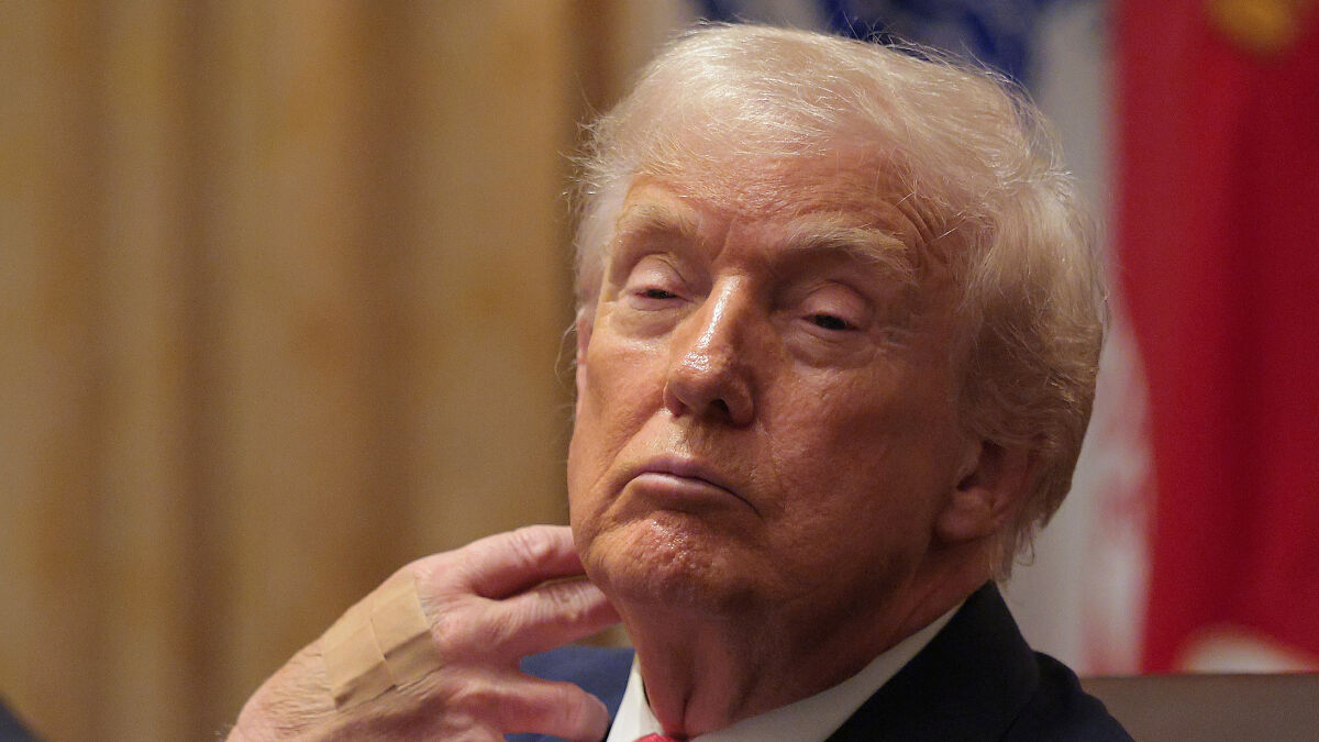 Donald Trump looking pensive with hand near neck, related to authoritarian post and disobey POTUS reactions online.