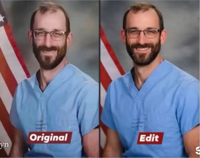 Side-by-side images of Alex Pretti in medical scrubs showing original and AI-altered images causing outrage